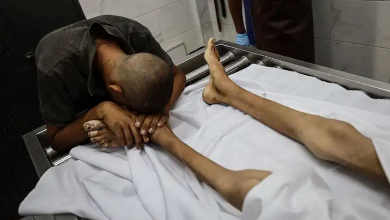 Gazze'de Açlık: Küçük Bir Çocuk Daha Hayata Veda Etti
